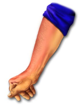 Arm with reddened skin