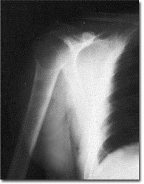 X-ray picture