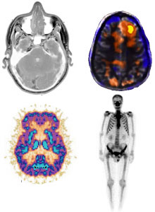 Example of nuclear medicine diagnostic image.