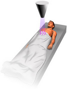 Person receiving radiotherapy